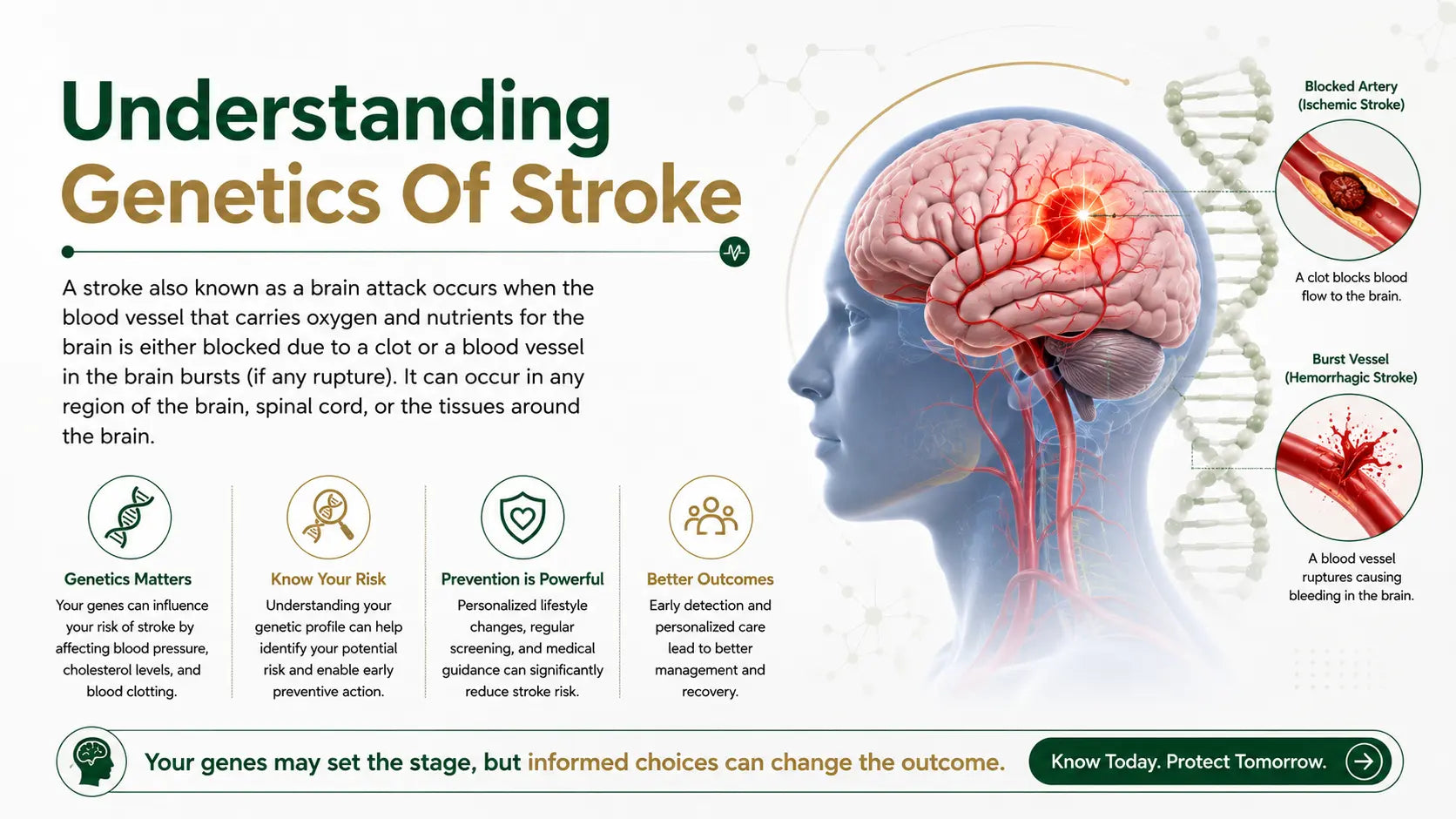 Understanding Genetics Of Stroke