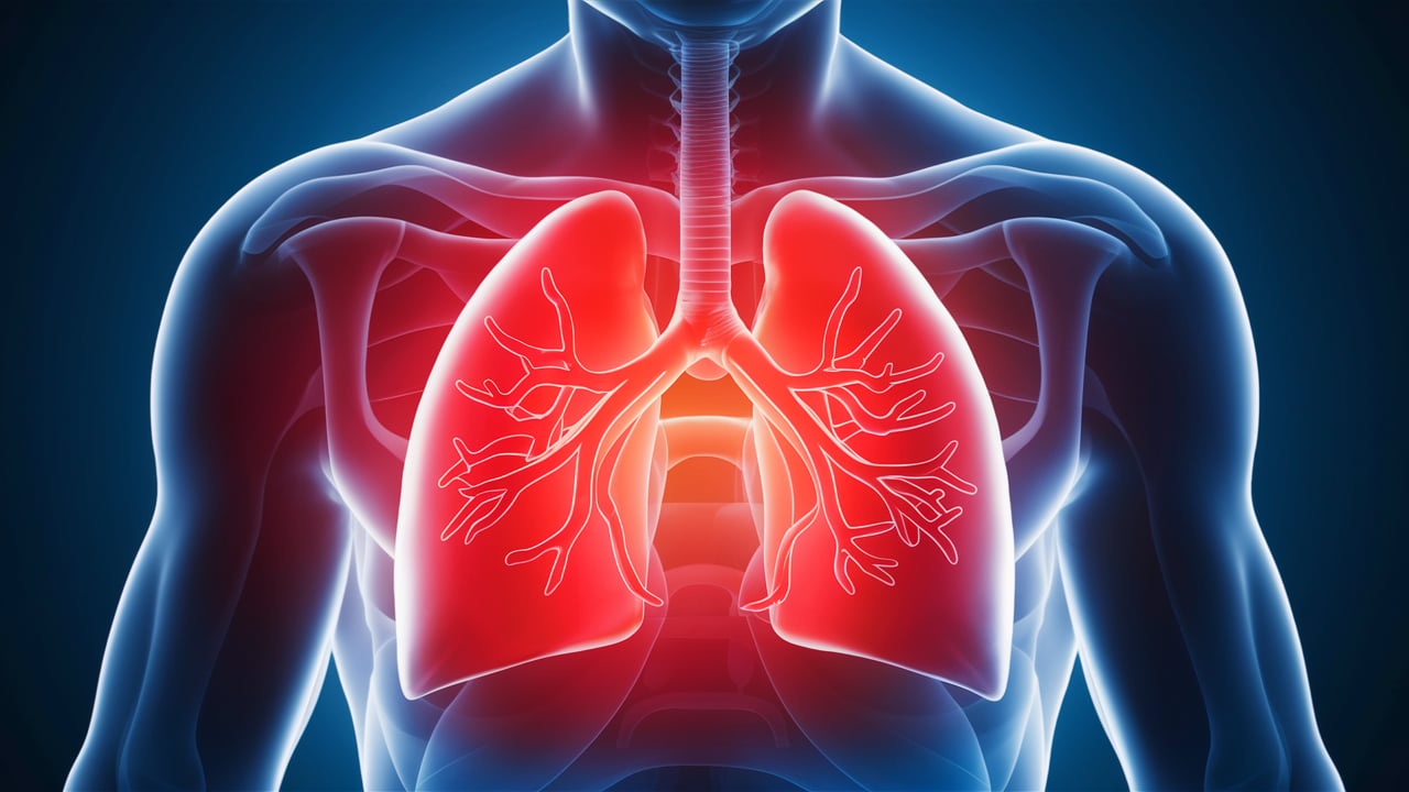 Understanding Lung Cancer - Causes, Treatments, and Genetic Testing with Genomepatri